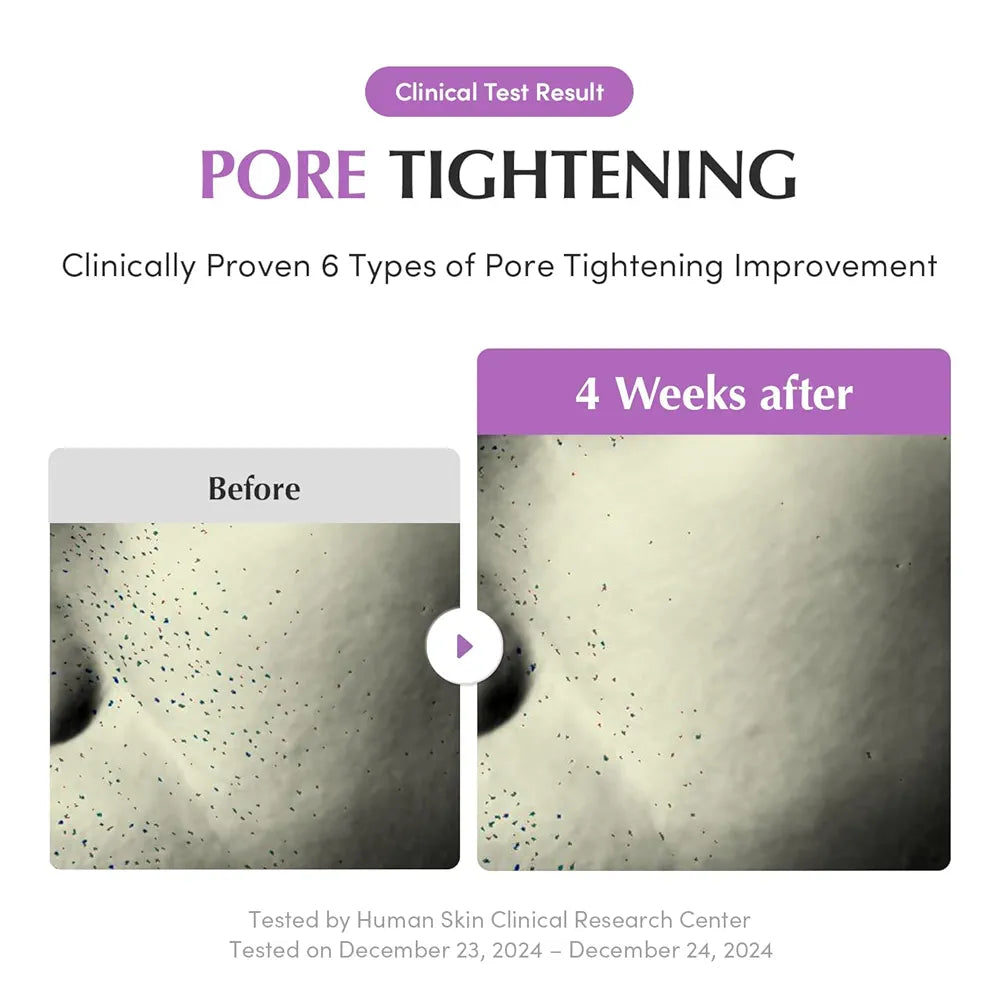 EQQUALBERRY – Purple PDRN Pore Minimizing Serum - 30ml