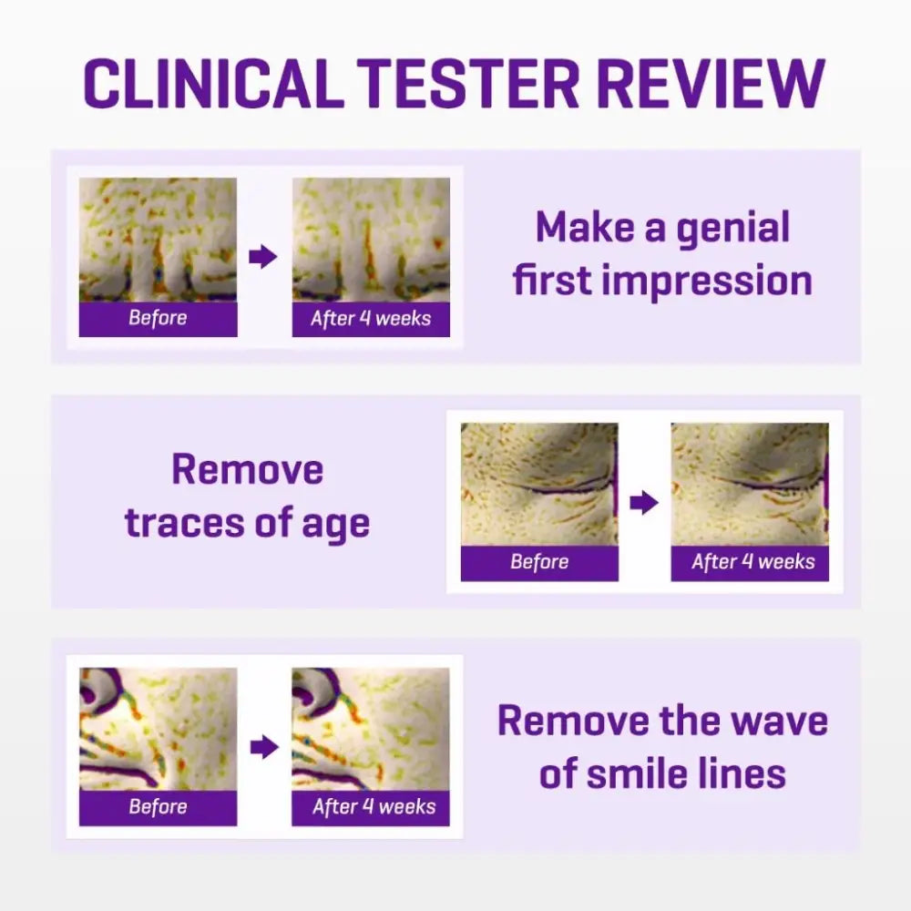 SOME BY MI - Retinol Intense Advanced Triple Action Eye Cream - 30ml