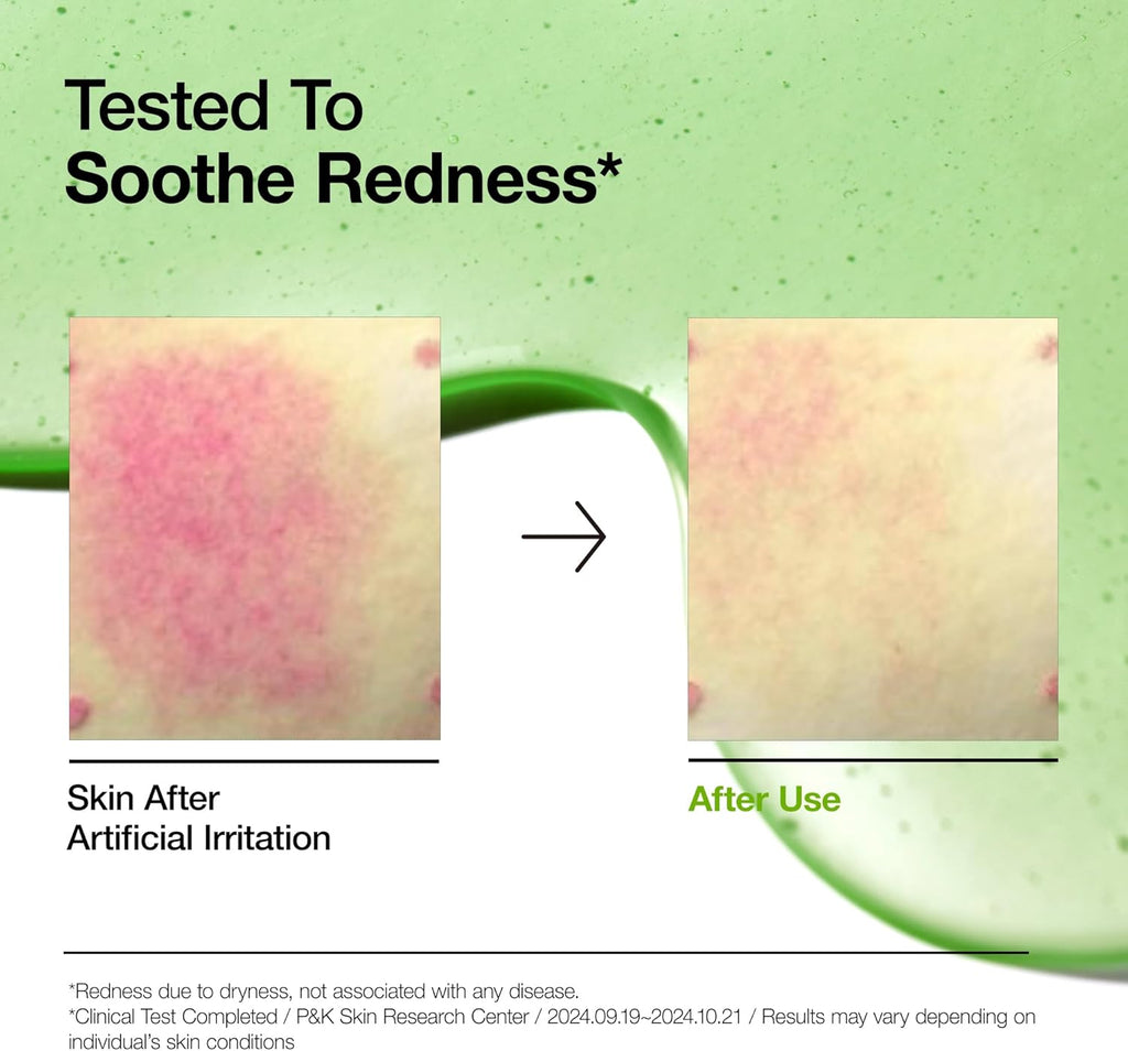 ANUA - Azelaic Acid 10+ Hyaluron - 30ml